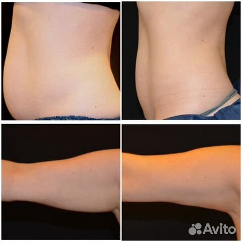 Жиросжигание Фито Гелем /Коррекция фигуры